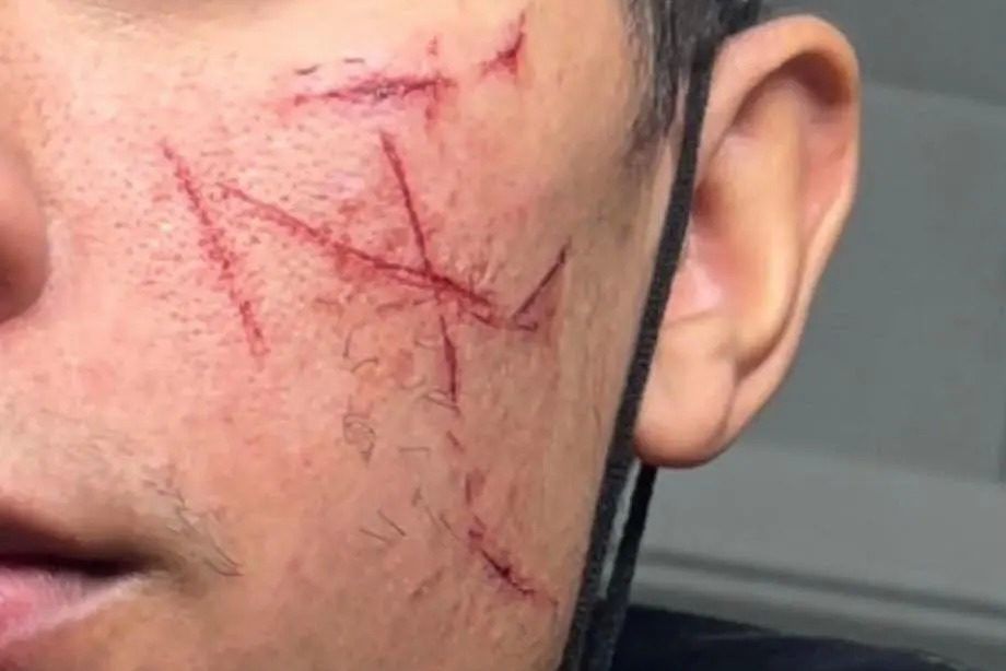 Le mytho neuchâtelois scarifié à bas QI se grille tout seul
